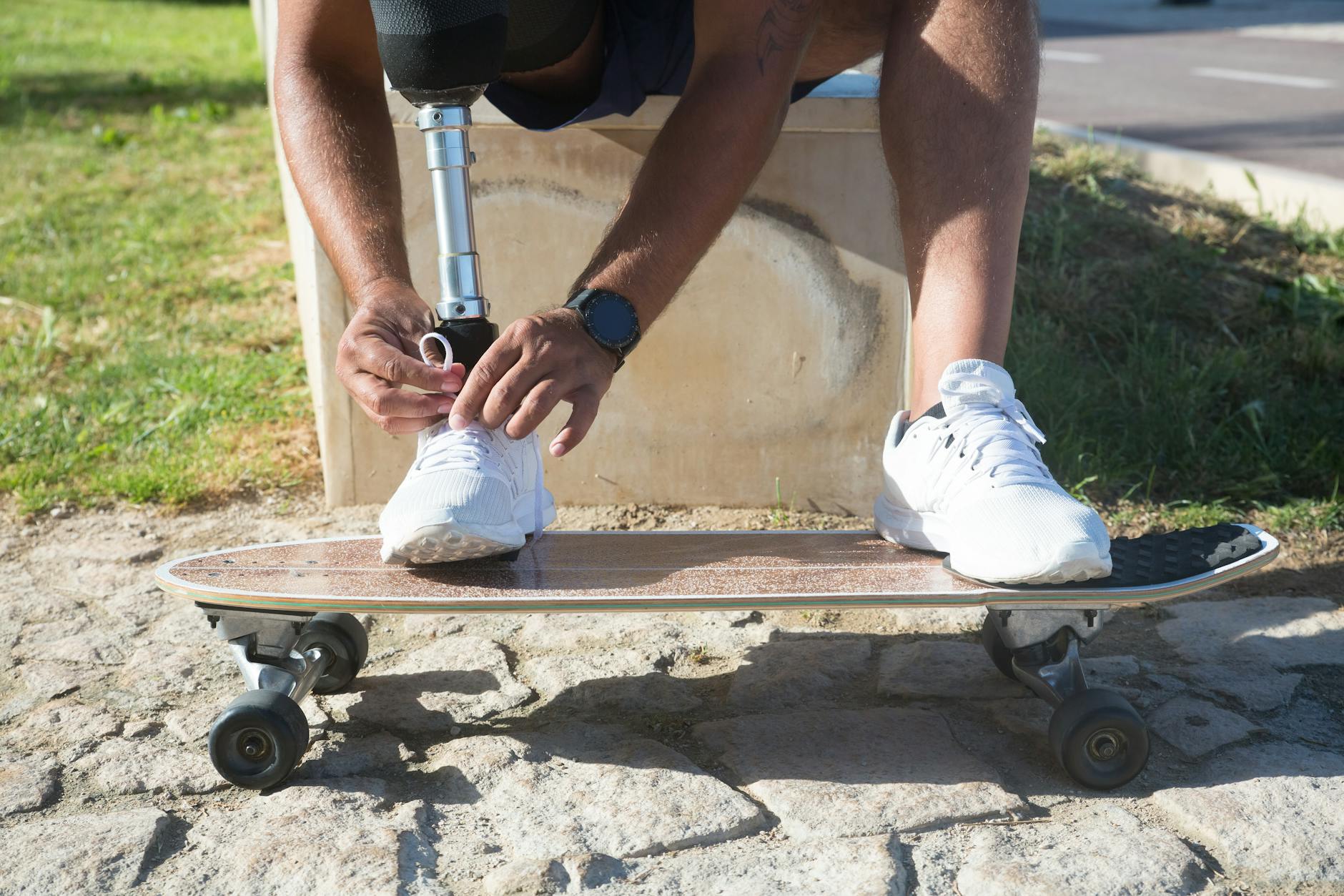 Stability Versus Decline—Understanding the Full Picture of MCI Outcomes