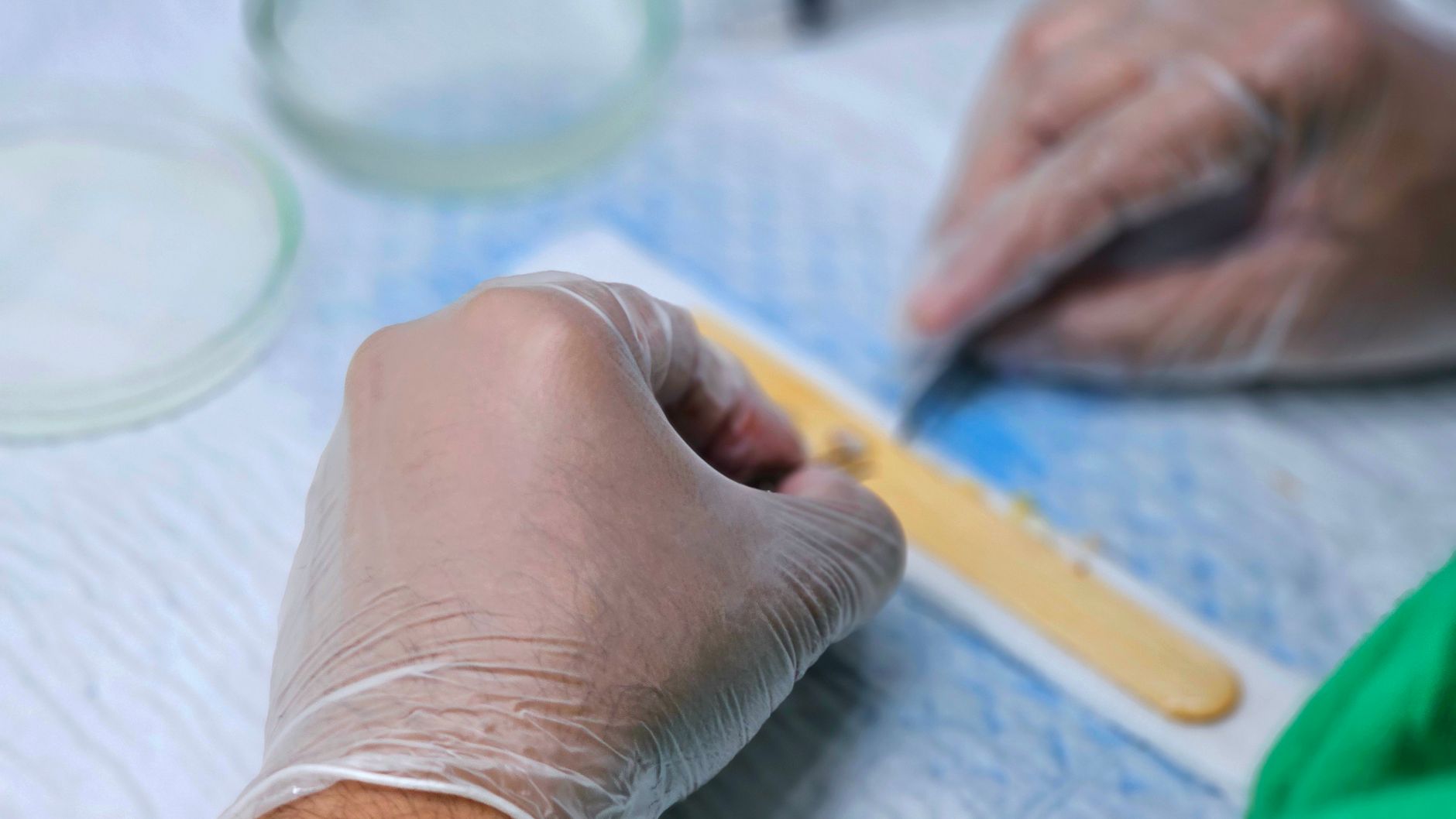 How Cataract Surgery Restores Independence and Prevents Decline in Older Adults
