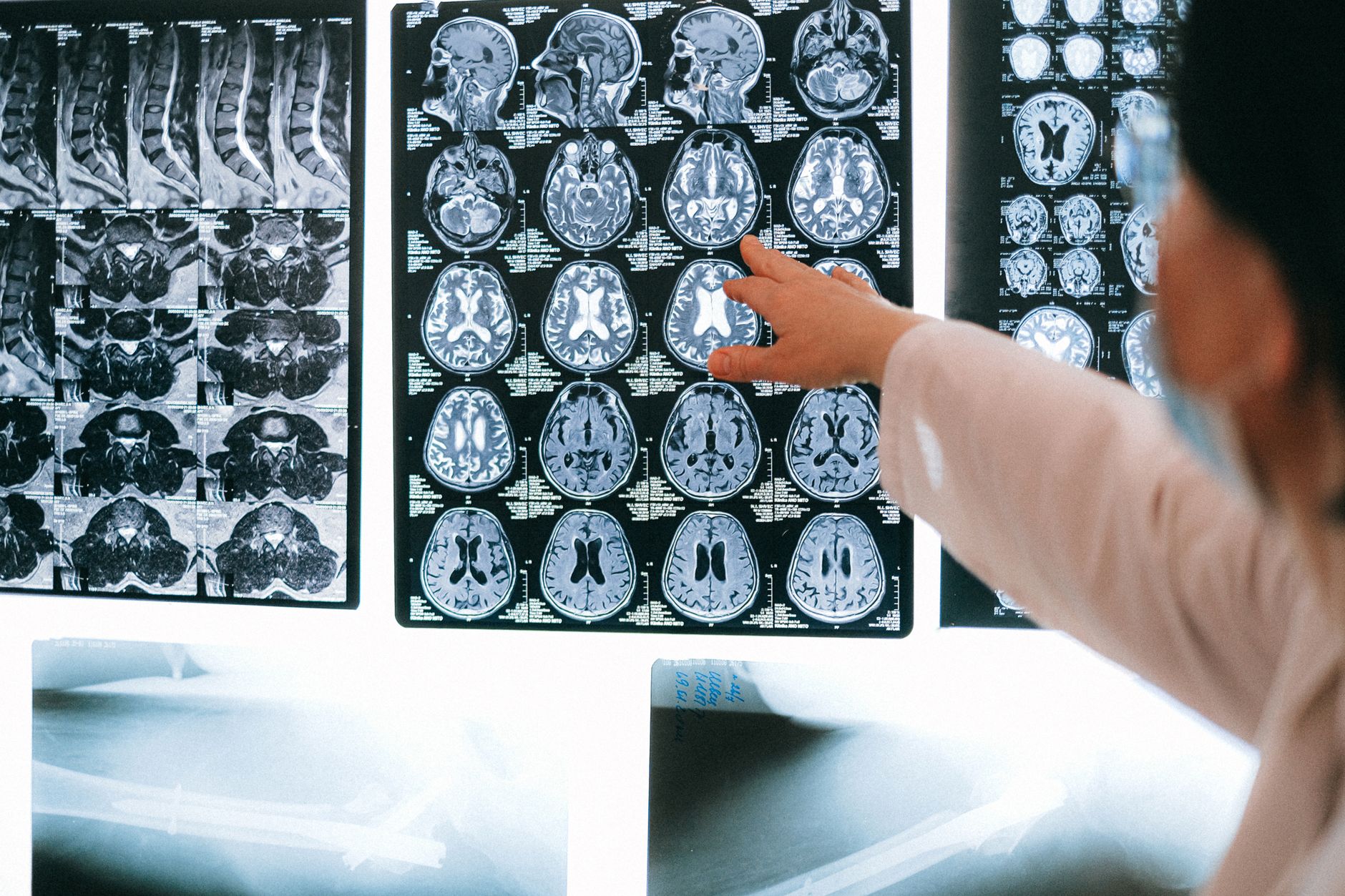 How Purpose Rewires Your Brain and Body for Longevity