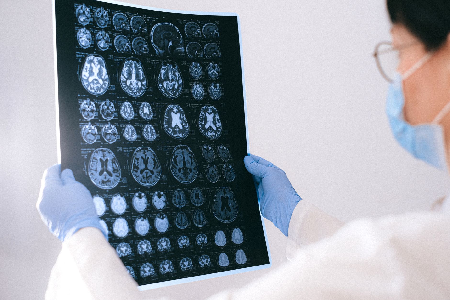 What Happens in the Brain and Body During the First Three Months After Stroke?