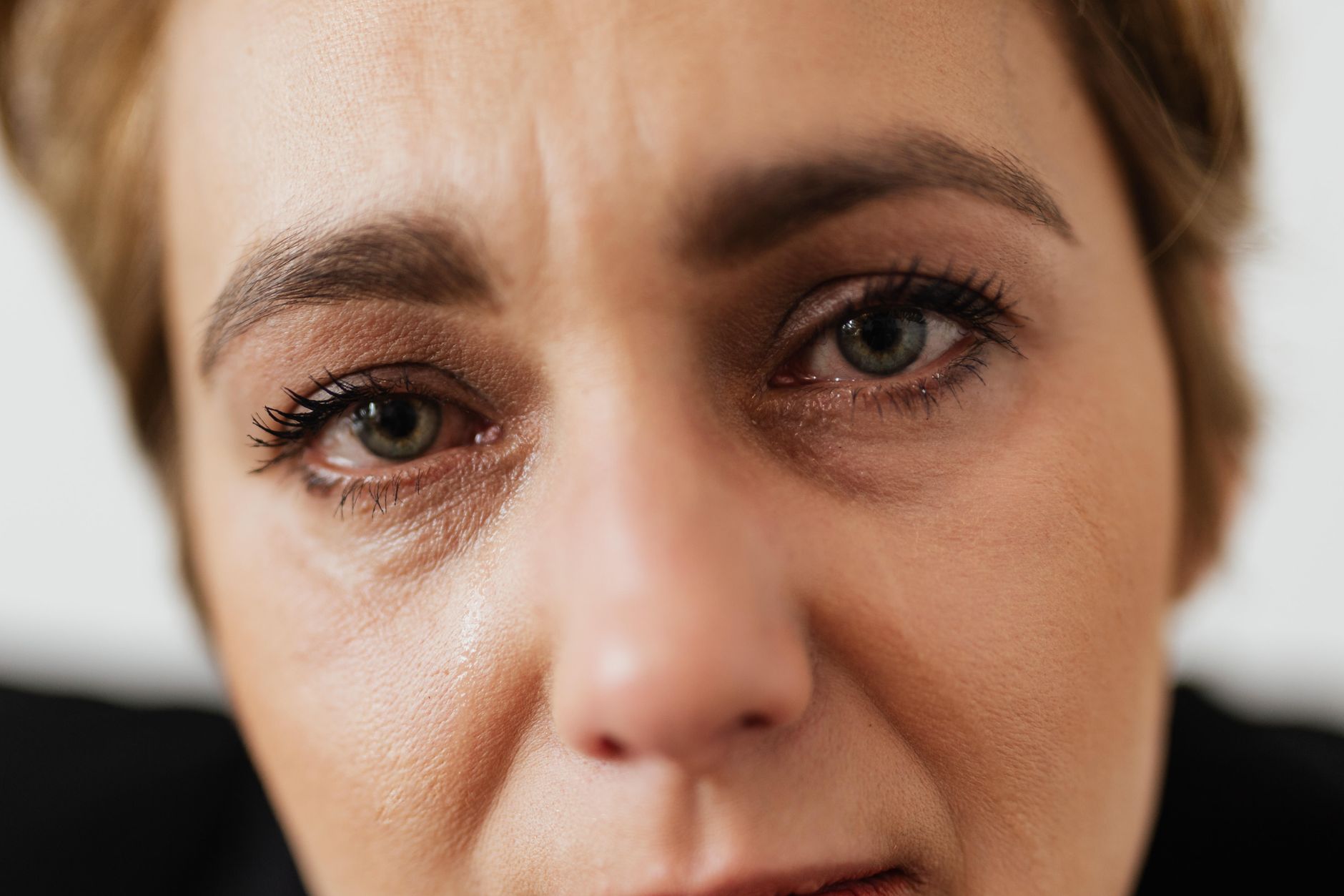 Where Skin Tears Happen Most Often and Why