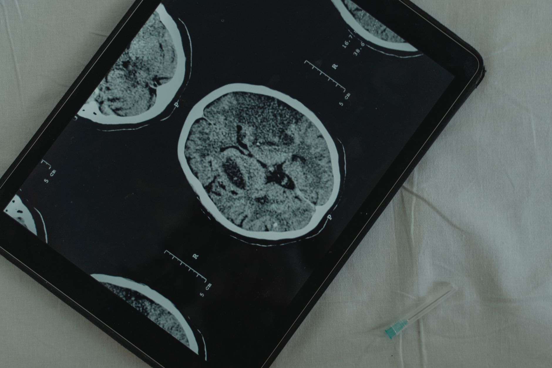 Cognitive Health and Brain Aging—Why Your Mind Needs Exercise Too