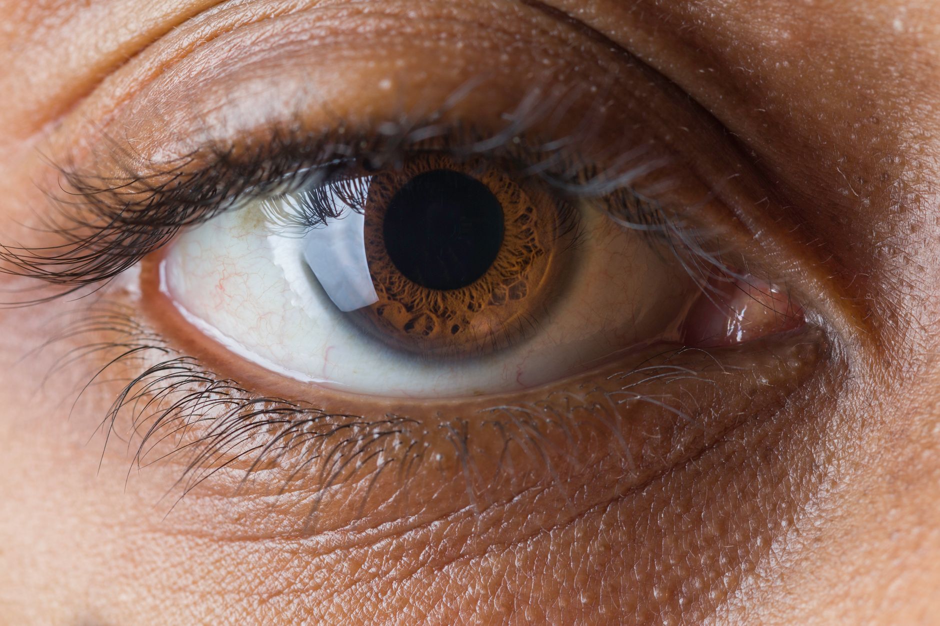 What Causes Vision Changes as You Age?